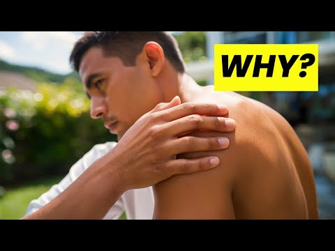 Why Sunburn Happens (Finally Explained)