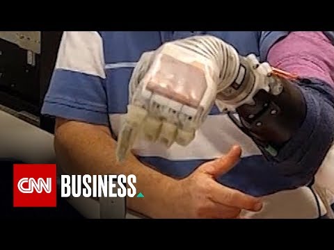 &#039;Star Wars&#039;-inspired prosthetic arm helps amputees feel again