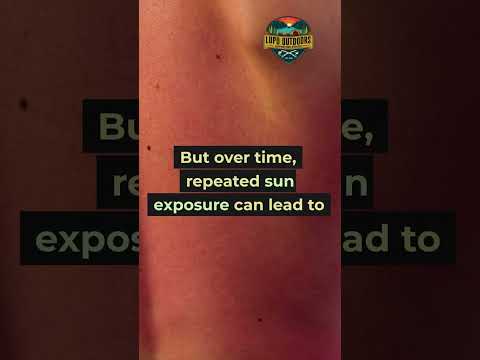 Did You Know? The Truth About Sunburn: What Really Happens to Your Skin #shorts